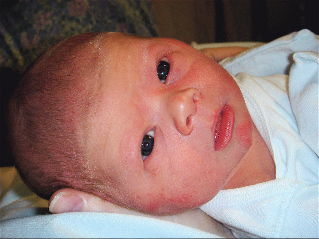 Rhett with his eyes opened
